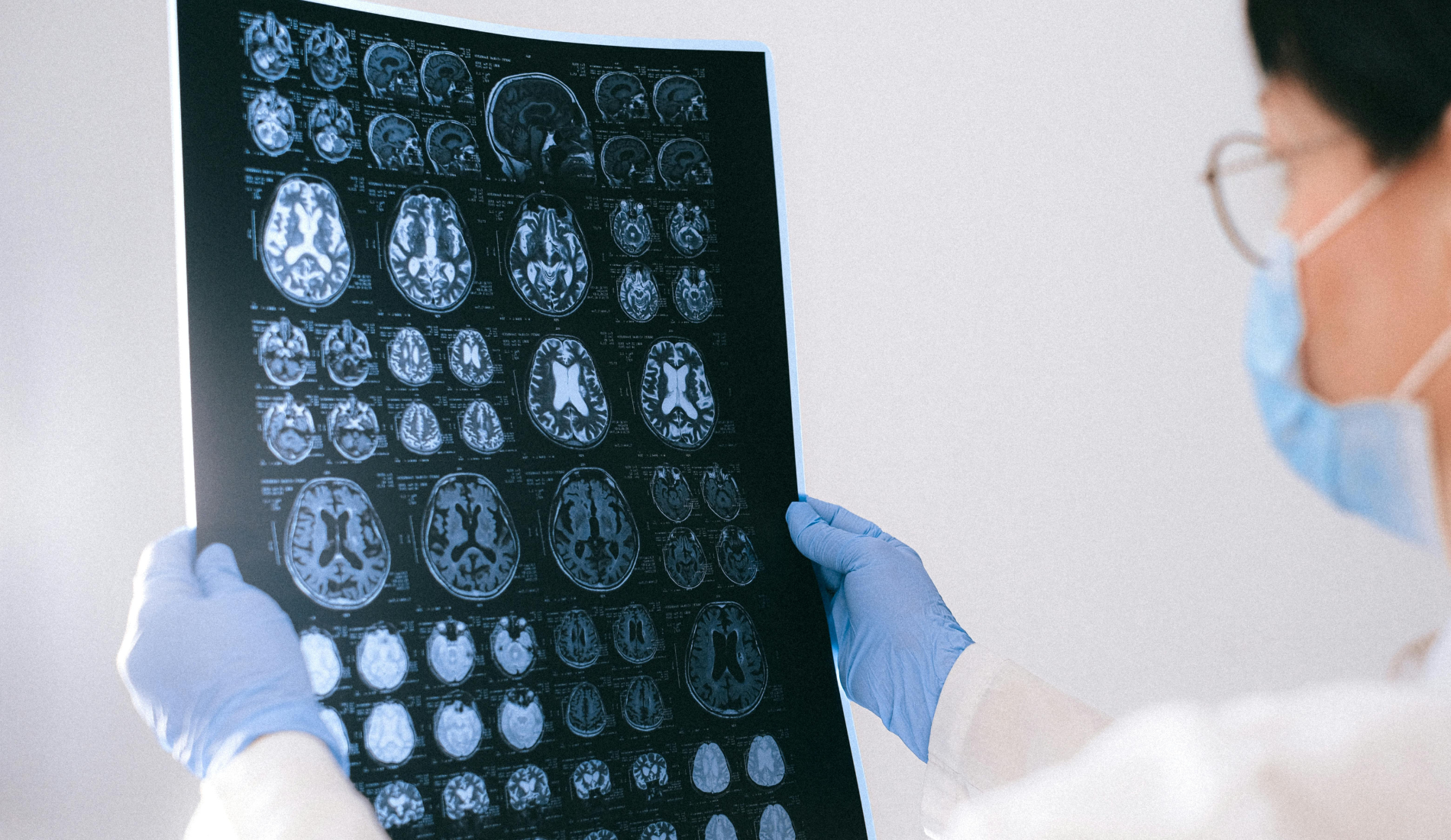 Why Better Brain Tumour Data Matters for Asia Pacific